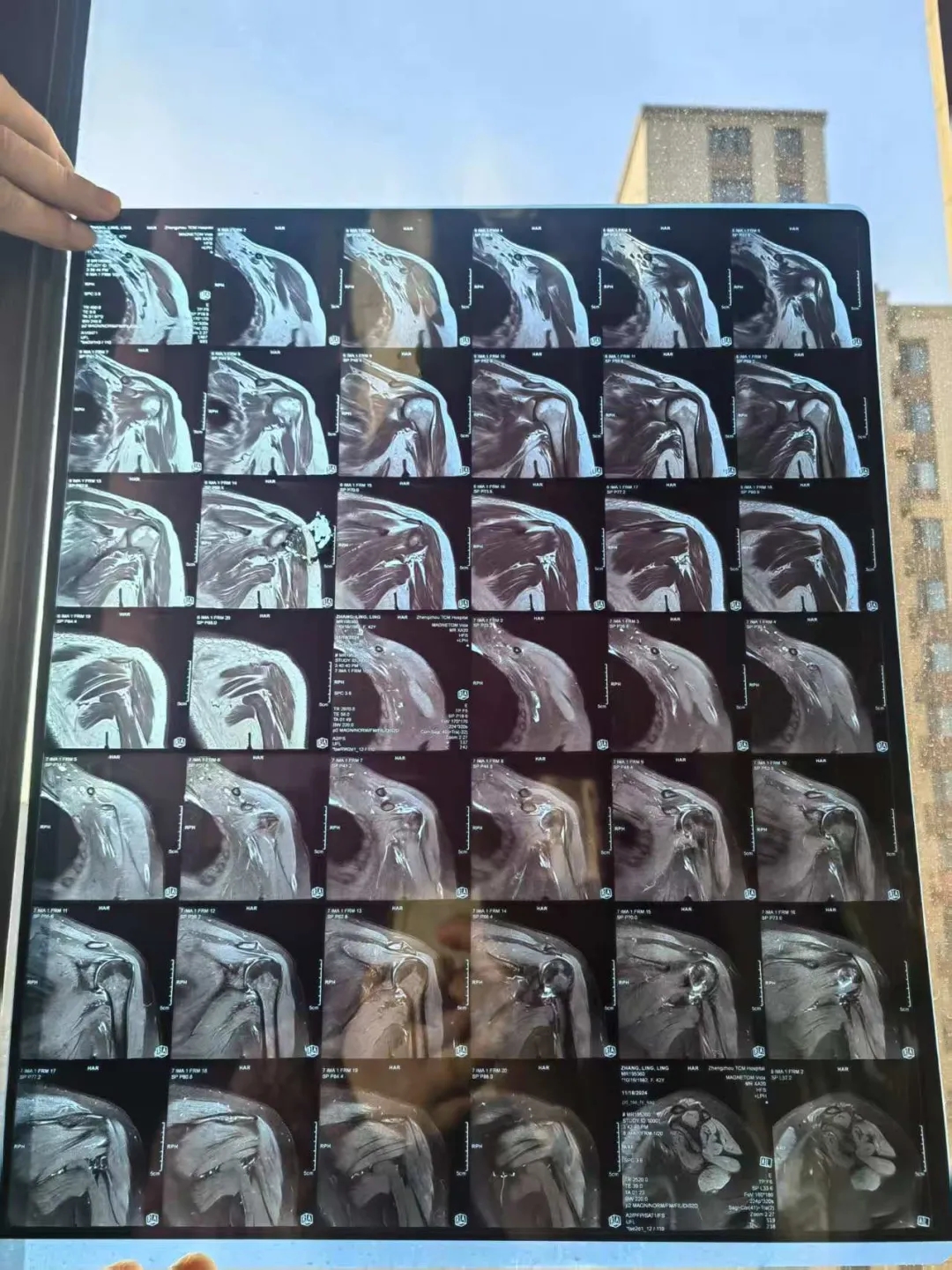 1763020320633131.jpg 738c1461314c26ecf199ac421a038eb4.jpg