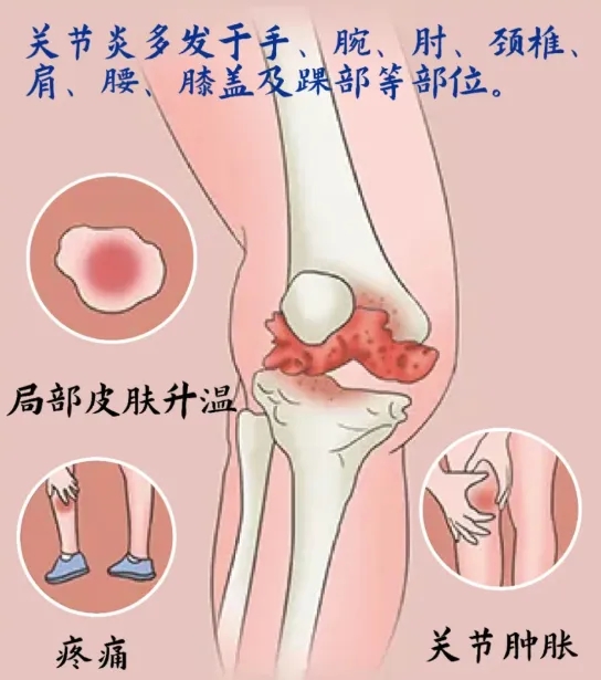 1763260851713615.jpg dfe9e2b679934de314aa3b50c24435cf.jpg