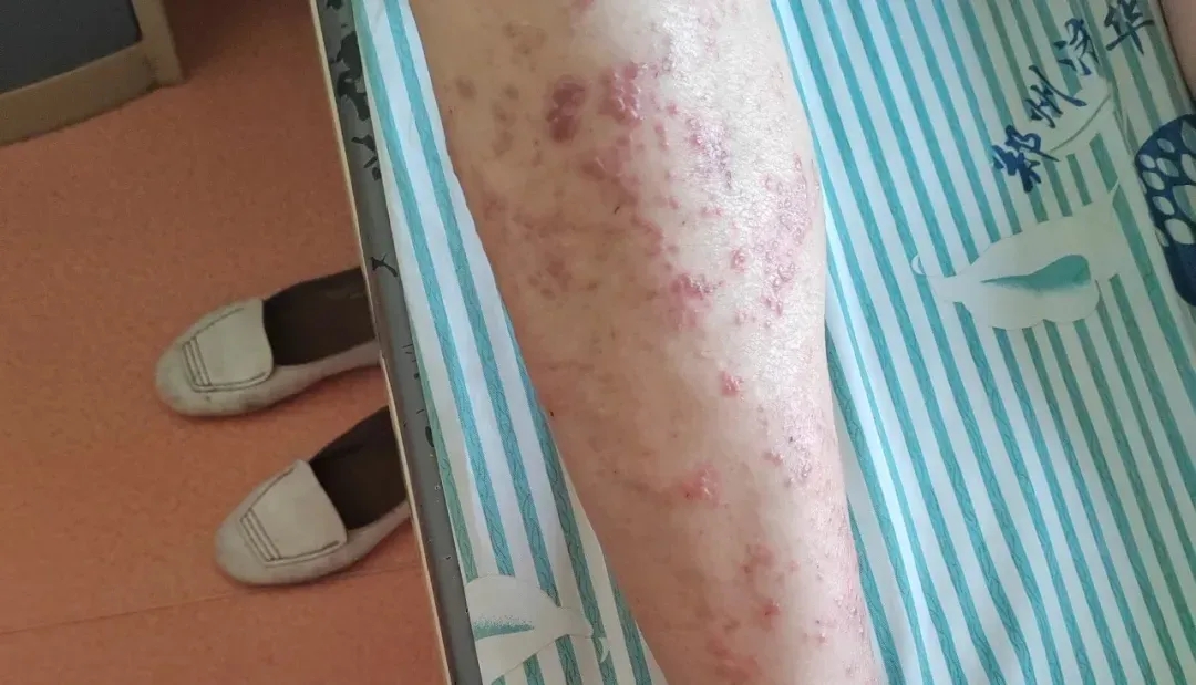 1763624917977052.jpg f48ad357f0cfda90eb33cda5c6affa73.jpg